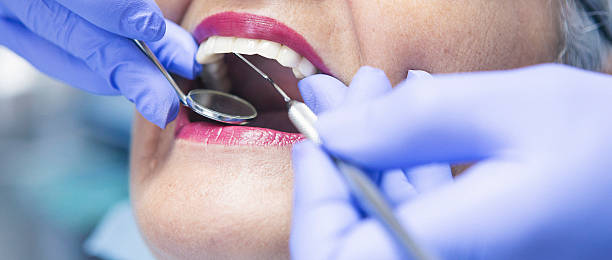 Best Lost Filling or Crown Replacement in Coarsegold, CA